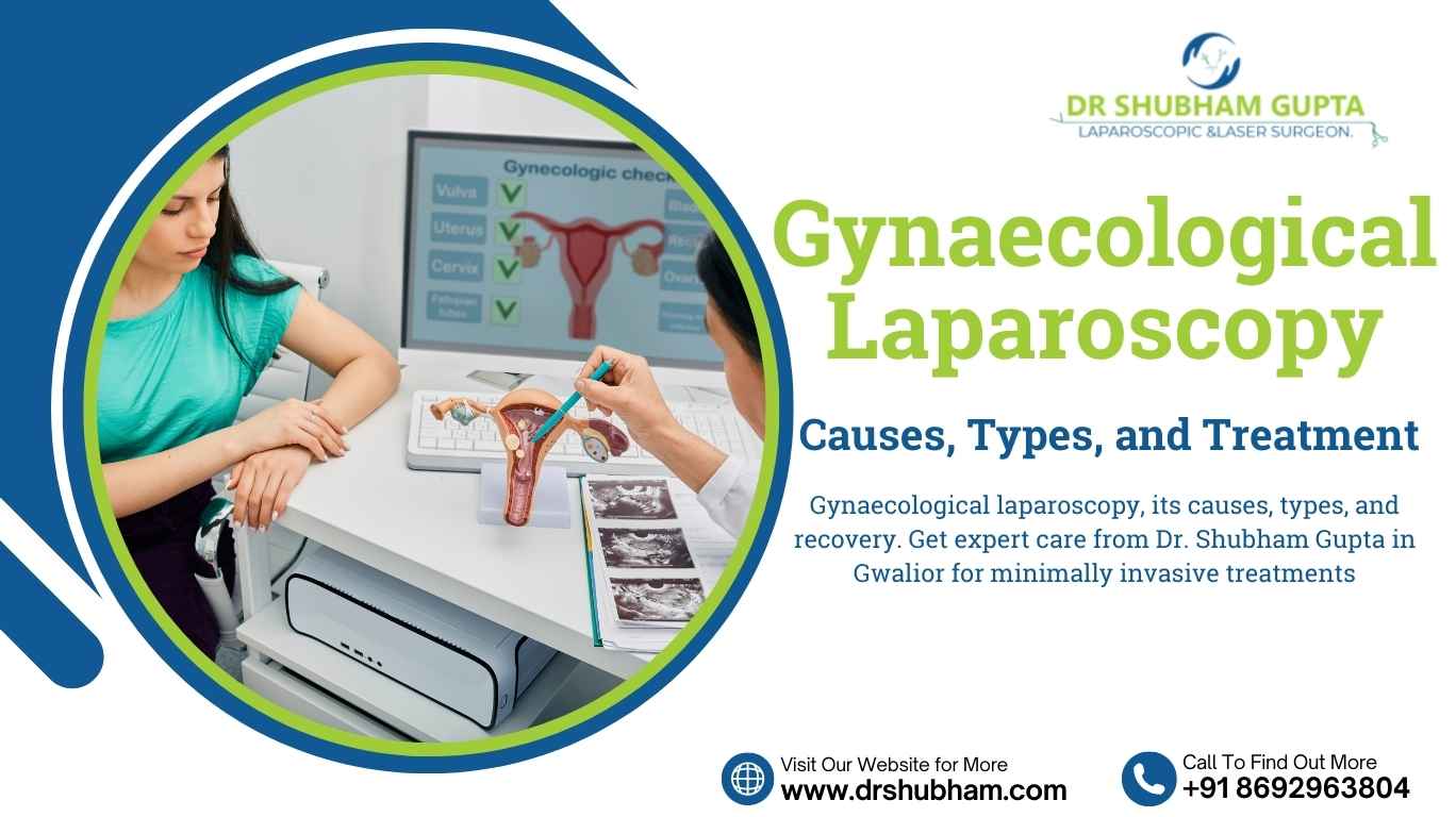 Gynaecological Laparoscopy – Causes, Types, and Treatment