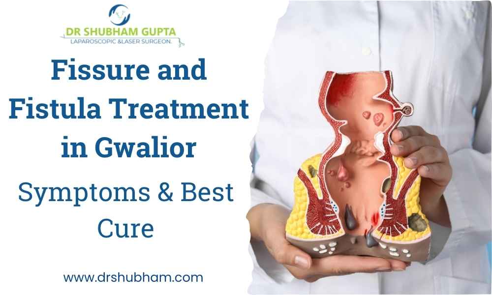 Fissure and Fistula Treatment in Gwalior: Symptoms & Best Cure