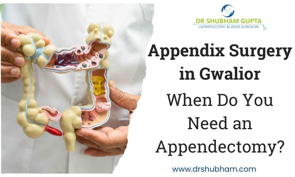 Appendix Surgery in Gwalior – When Do You Need an Appendectomy?