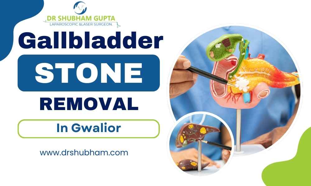 Gallbladder Stone Removal in Gwalior – Dr. Shubham Gupta