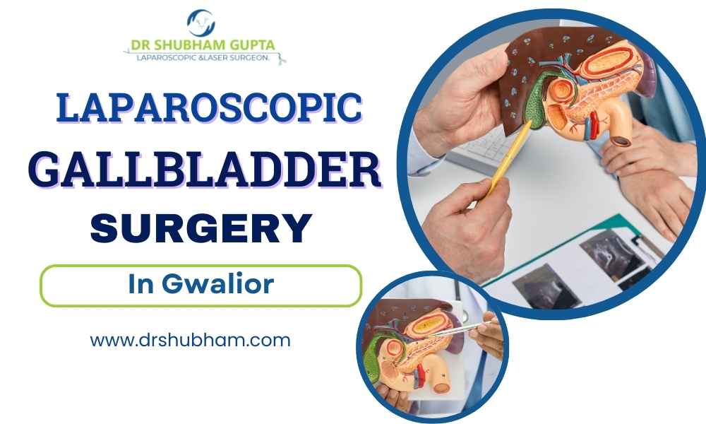 Laparoscopic Gallbladder Surgery in Gwalior – Dr. Shubham Gupta