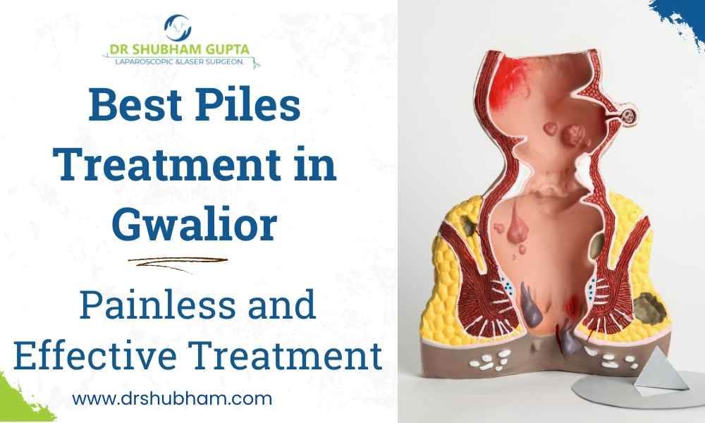 Best Piles Treatment in Gwalior – Dr. Shubham Gupta
